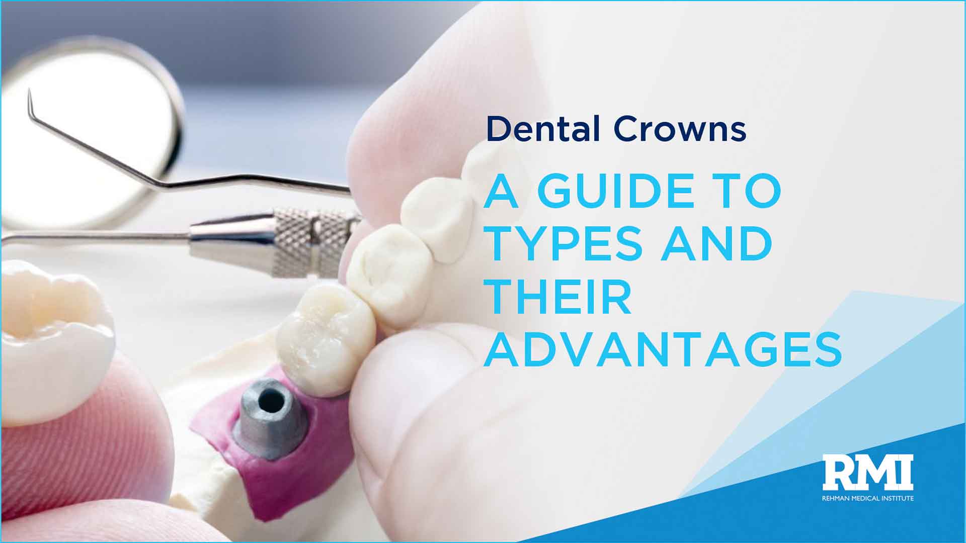 Dental Crowns: A Guide to Types and Their Advantages