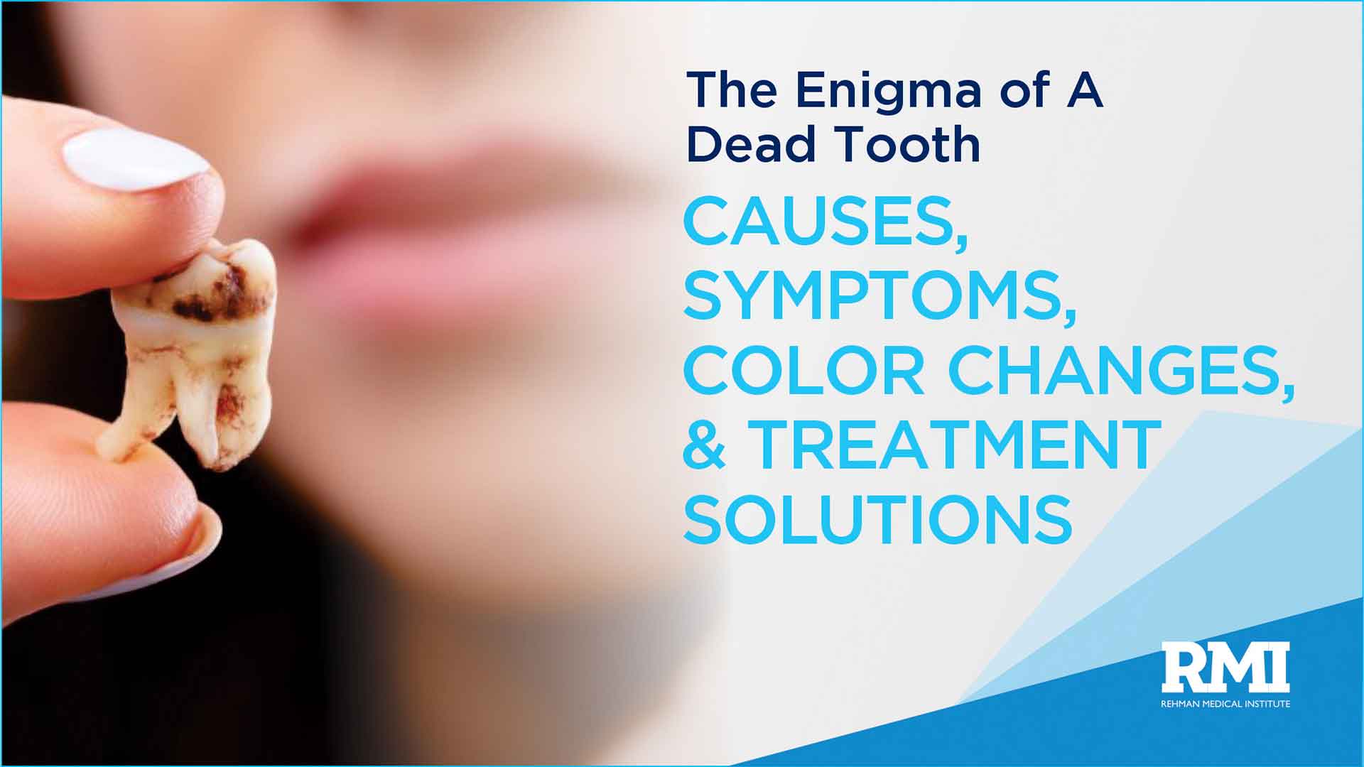 The Enigma of a Dead Tooth: Causes, Symptoms, Color Changes, and Treatment Solutions