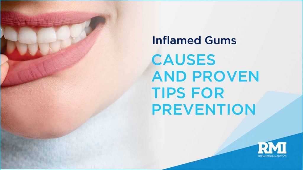 inflamed gums