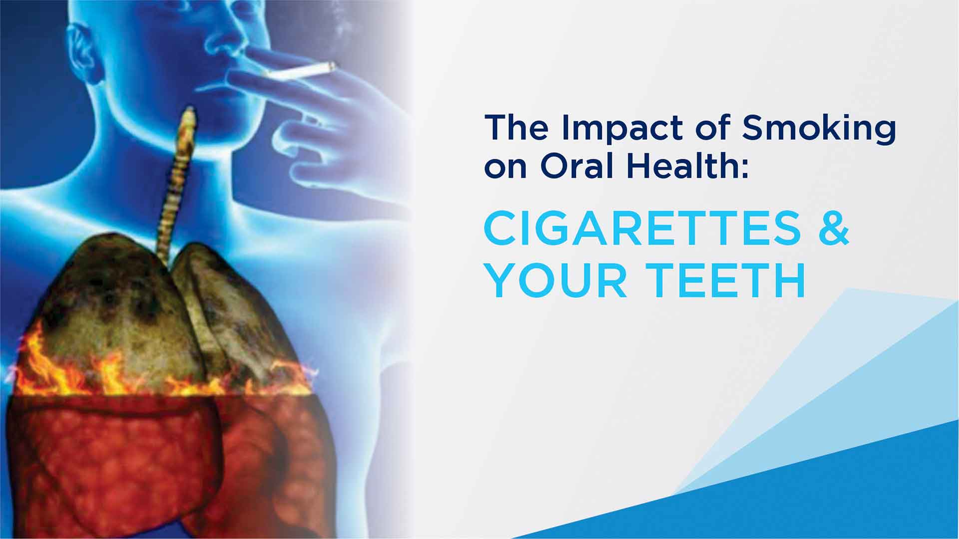 The Impact of Smoking on Oral Health: Cigarettes & Your Teeth